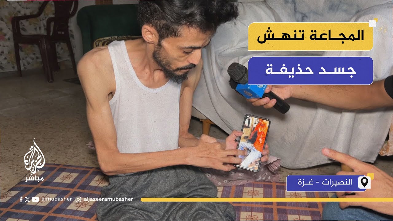 المجاعة تنهش جسد الشاب الرياضي حذيفة في غزة