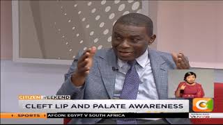 | CITIZEN WEEKEND | Cleft Lip and Palate Awareness screenshot 5