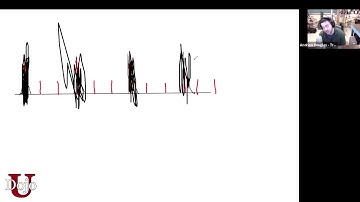 Tick Tick of the Met is Painful. All Sane and Logical.