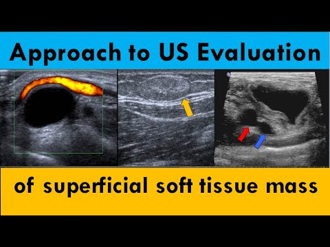 Approach to ultrasound