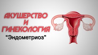 Акушерство и гинекология №1 "Эндометриоз"