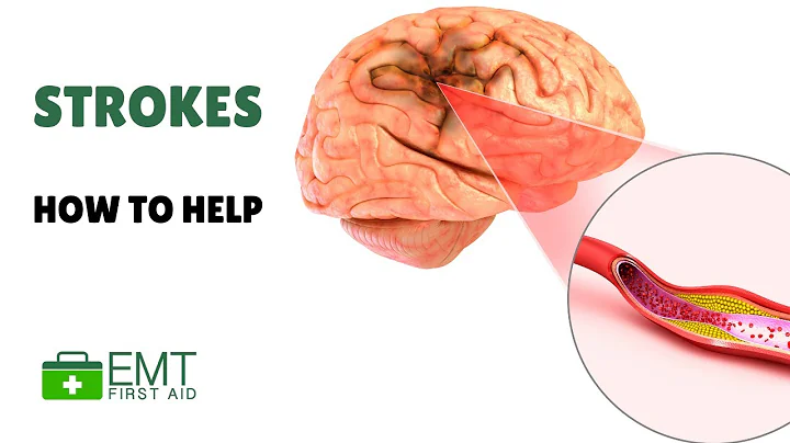 Ischemic + Hemorrhagic Strokes Symptoms and Treatment |  Adult First Aid  | EMT First Aid Training