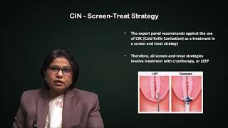 Cin  Grades Choice Of Treatment  Cytology Report