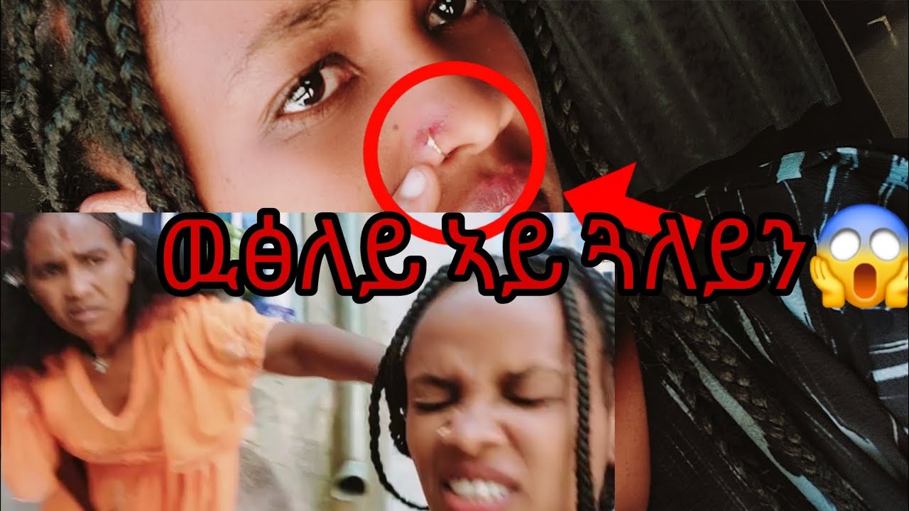 ኣፍንጨይ ተሻቒረስ ዓቢዳ መኣዛ😭 ስላሴ ይፍረዱኺ ንዝወለደተት ኣይወቅዕይ😱