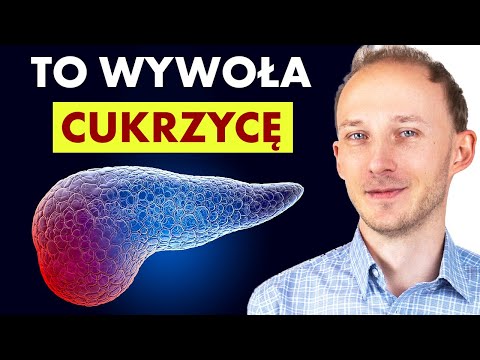 Wideo: Rodzaje kłamstw: 14 sposobów, aby się z nimi zmierzyć i nie schudnąć