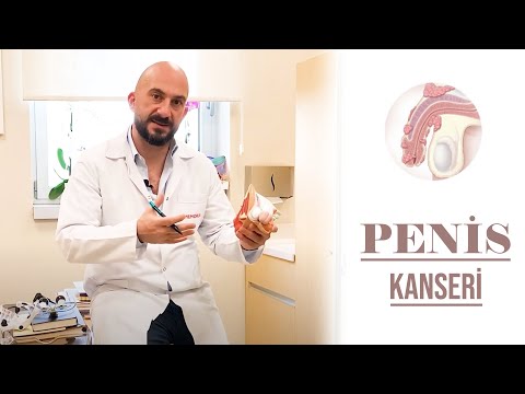Dr. Miraç Turan - Penis Kanseri
