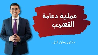 دعامة القضيب في  العضو الذكري خطوة بخطوة