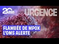 Ref:u-o5Mk4F2hM Mpox : l oms maintient son alerte mondiale face � la flamb�e des cas
