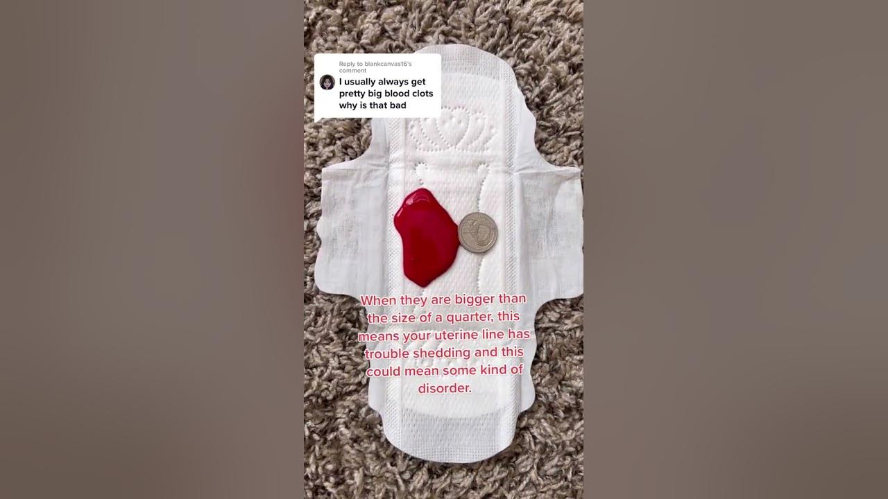 Are Big Blood Clots Normal? YouTube