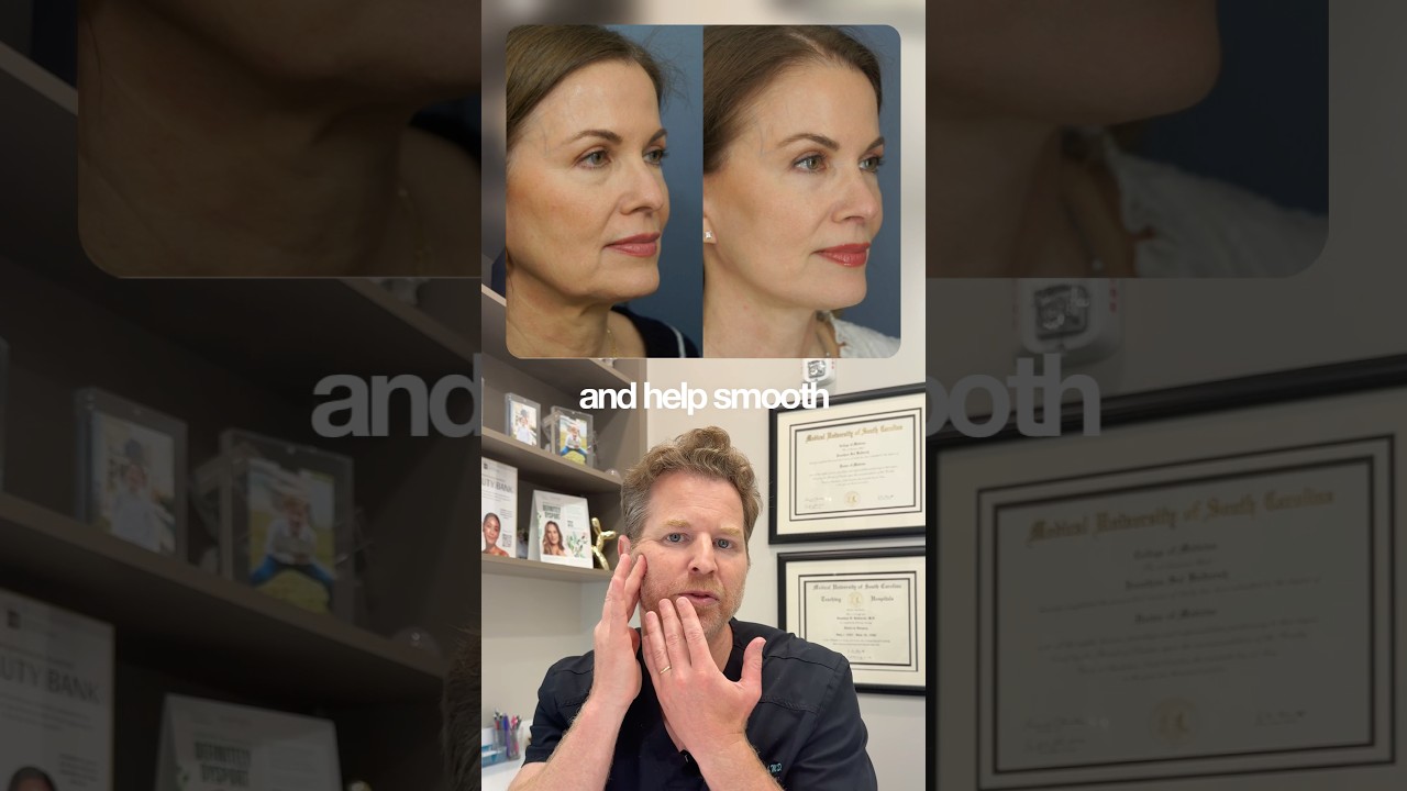 How I Achieve Natural Looking Facelift Results