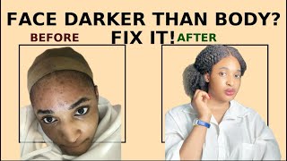 Why Your Face Is Darker Than Your Body & How to Fix It | Skincare Tips for Even Skin Tone