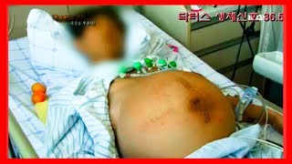 술만 마시면 딱딱해지는 장기가 있는데 무엇? | 닥터스 응급실24 응급의학과 의사 119 구급대원 의학 다큐 다시보기