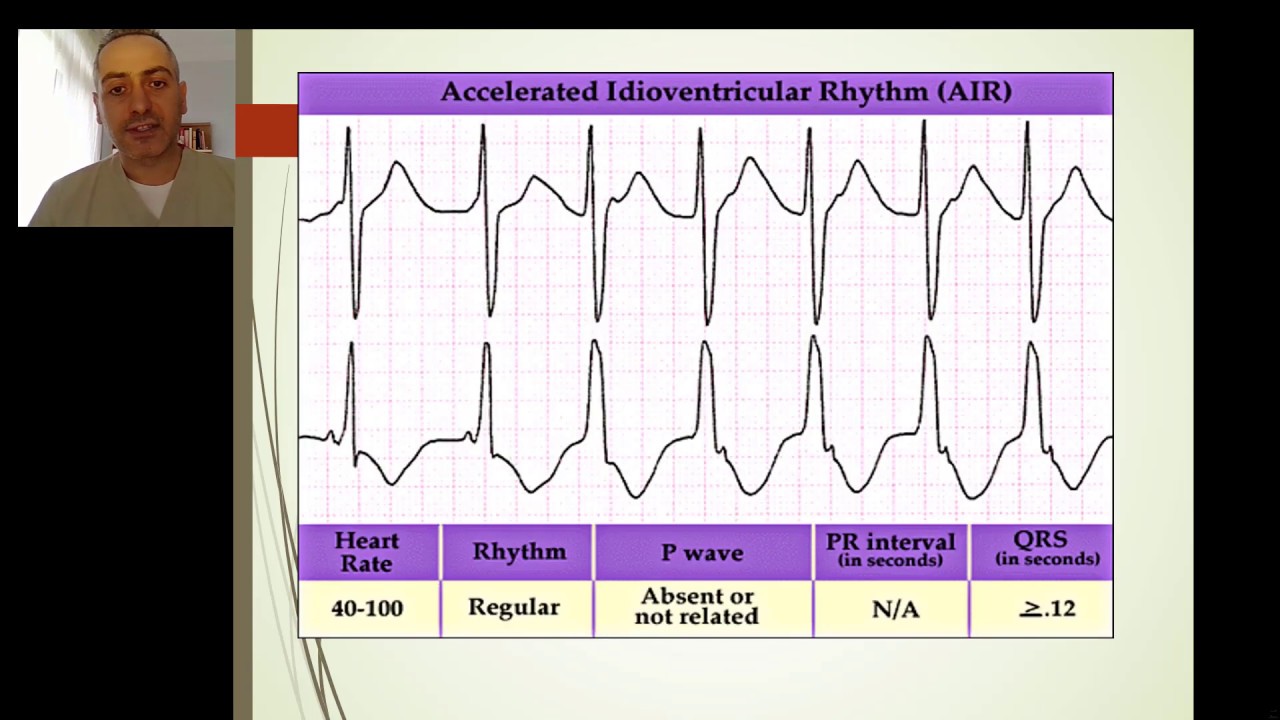 SAÜ Tıp Fakültesi Kardiyoloji Stajı: Aritmilere yaklaşım 1: Taşikardiler