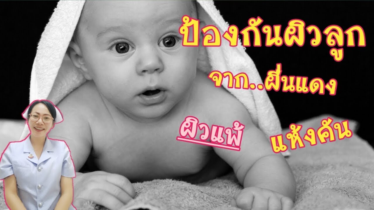 วิธีป้องกันลูกน้อยจากผื่นแดง ผิวแห้งคัน ระคายเคือง|Nurse Kids