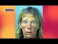 The Most Frightening Crystal Meth Users Ever Seen.. - YouTube