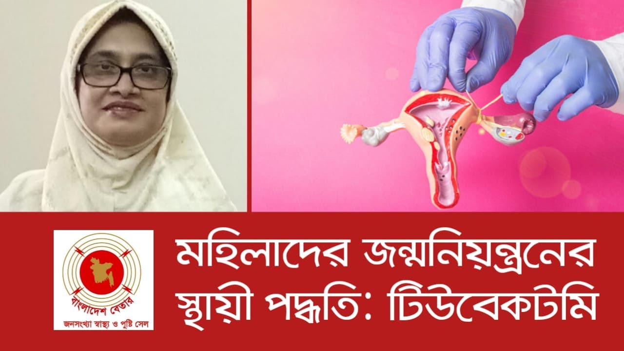 Permanent Birth control Methods For Female মহিলাদের জন্মনিয়ন্ত্রণের