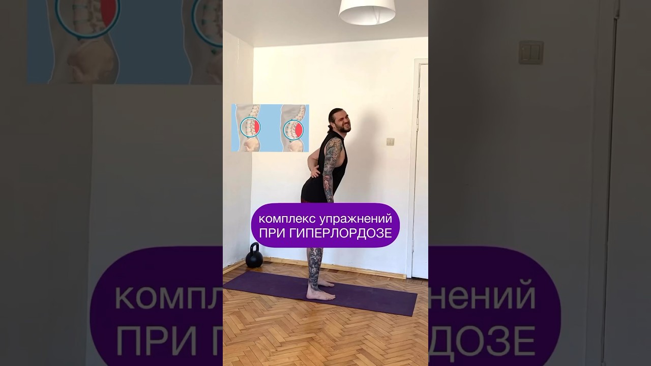 КАК ИСПРАВИТЬ ГИПЕРЛОРДОЗ? 5 упражнений