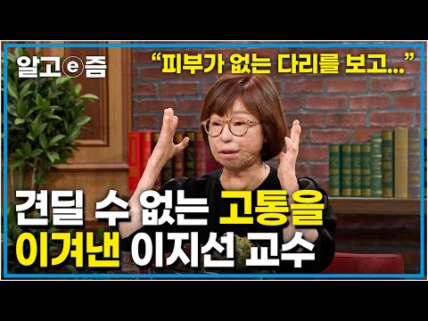   차를 타고 함께 귀가 중 만취 운전자로 인한 교통사고 상반신에 불이 붙은 채 구조 되었던 이지선 교수의 고통을 이겨낸 희망 스토리 지선아 사랑해 EBS 초대석 알고e즘