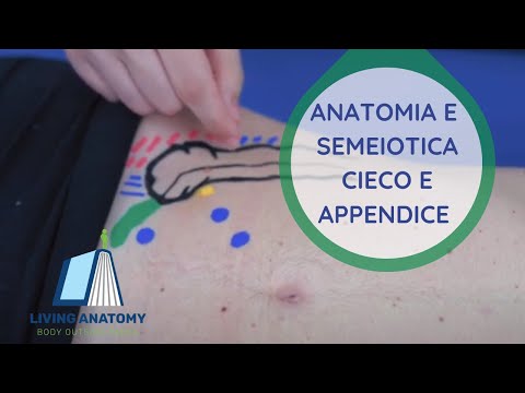 Video: Differenza Tra Cieco E Appendice