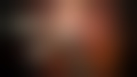 Robotic cholecystectomy - exploration - Dr.Konstantinidis