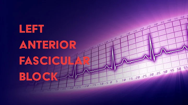 Left Anterior Fascicular Block - How to Read an Electrocardiogram (EKG) - MEDZCOOL