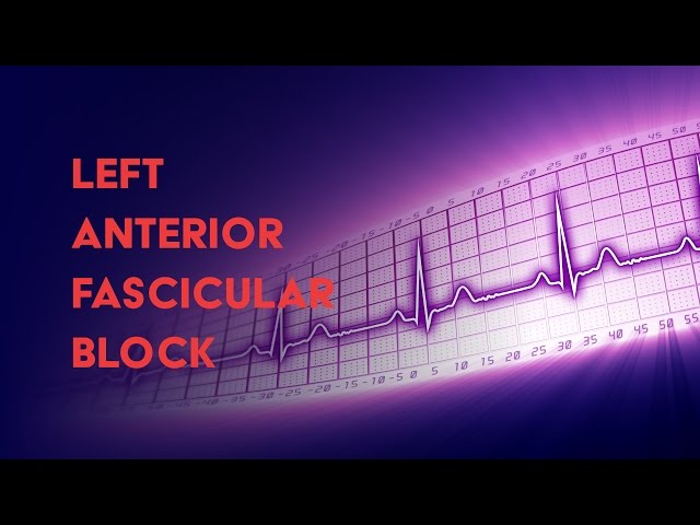 Left Anterior Fascicular Block - How to Read an Electrocardiogram (EKG) - MEDZCOOL class=