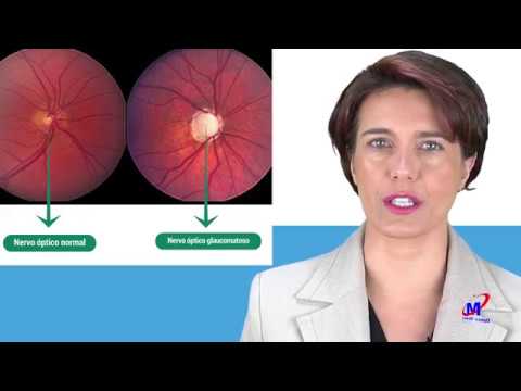 Vídeo: Atrofia Do Nervo óptico - Causas, Sintomas E Tratamento