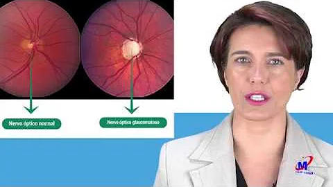Porque o nervo óptico atrofia?