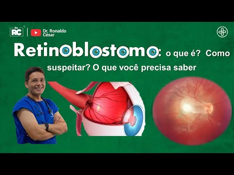 Retinoblastoma: o que é? como suspeitar? e o que você precisa saber