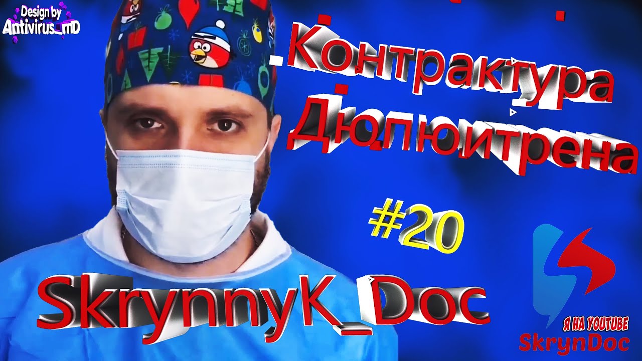 Контрактура Дюпюитрена (Ладонный Фиброматоз). Skrynnyk_Doc 👈