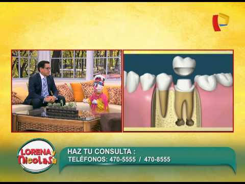 Vídeo: Endodoncia: Propósito, Procedimiento Y Riesgos