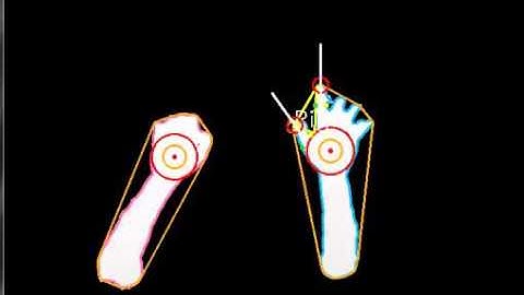 Kinect Hand Tracking, Finger Tracking and Simple Static Gesture Recognition