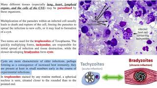 Toxoplasmosis | Toxoplasma gondii | التوكسوبلازما أو المقوسة الغوندية