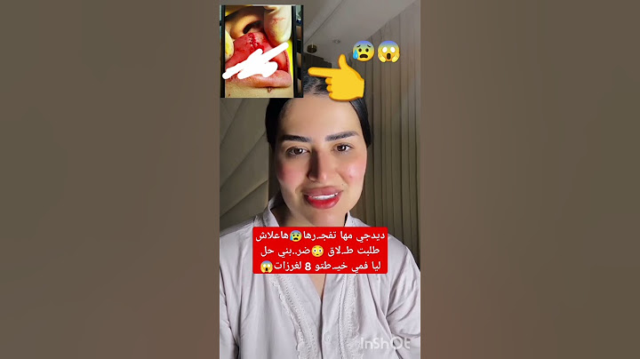 ها علاش طلبت طلاق منو 😳نافسة فشهري الأول حل ليا فمي 8لغرزة😱 #مشاهير