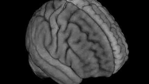 AFNI 3dQwarp vs. FSL FNIRT