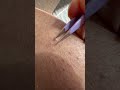 INGROWN Hairs Are The Devil ЁЯШИ Sugarwax Shorts INGROWN Hairs Are The Devil ЁЯШИ Sugarwax Shorts