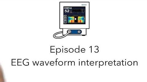 Bispectral Index™ Byte 13: EEG Waveform Interpretation
