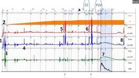 ICS 2020  W26 Basic Urodynamics - An Interactive Workshop