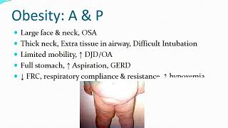 Obesity Issues in Anesthesia dlho