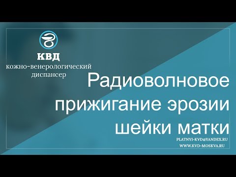 601  Радиоволновое прижигание эрозии шейки матки