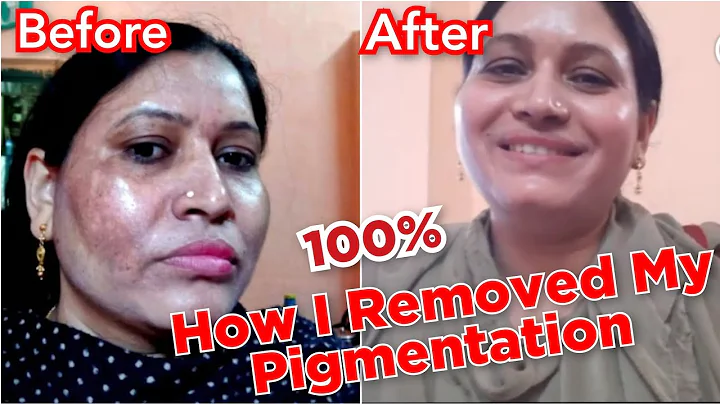 2 Mahine mai Pigmentation Khatam |  Magic of Bumper Remedy | Cooking with Sultana