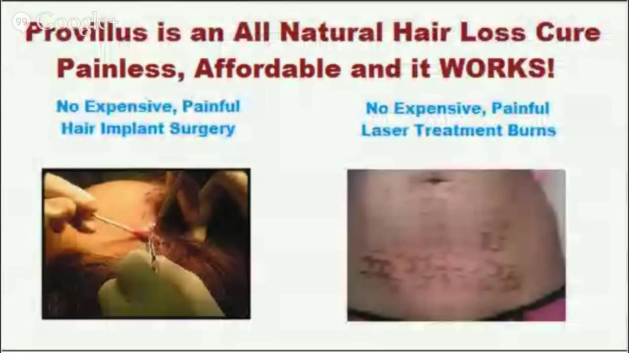 Homeopathic Cure for Hair Loss Hair Loss Control YouTube