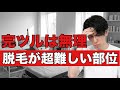 脱毛で完全無毛のツルツルは諦めた方が良い理由と脱毛のお勧めのゴールについて解説