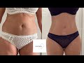 Liposuccion ou abdominoplastie haute tension  