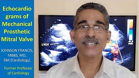 Echocardiograms of Mechanical Prosthetic Mitral Valve