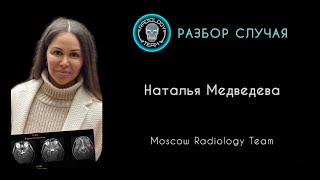 РАЗБОР СЛУЧАЯ 6 /НАТАЛЬЯ МЕДВЕДЕВА / MOSCOW RADIOLOGY TEAM