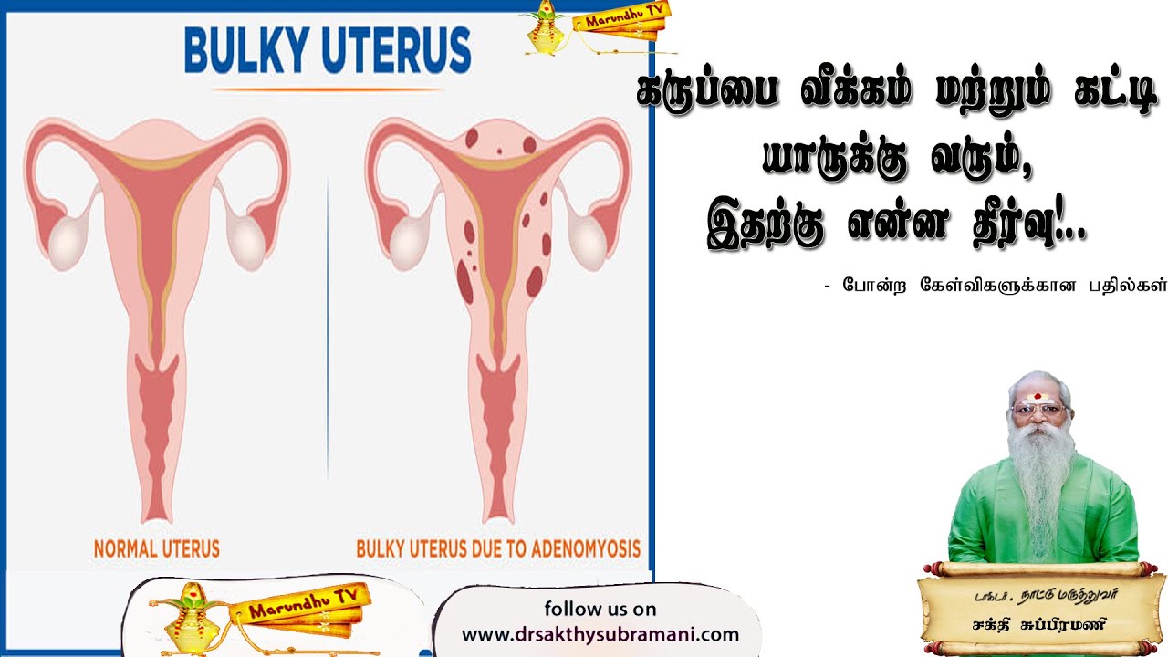 கருப்பை வீக்கம் மற்றும் கட்டி யாருக்கு வரும் , இதற்கு  என்ன தீர்வு?