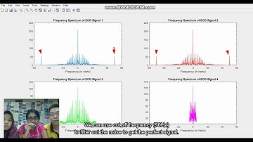 Digital Signal Processing (Filtering of noise from ECG signals) [Group 12]