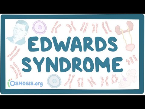 Video: Jak vzniká Edwardsův syndrom?