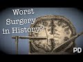 The Dark side of Science: The Lobotomy, the worst surgery in history? (Documentary)